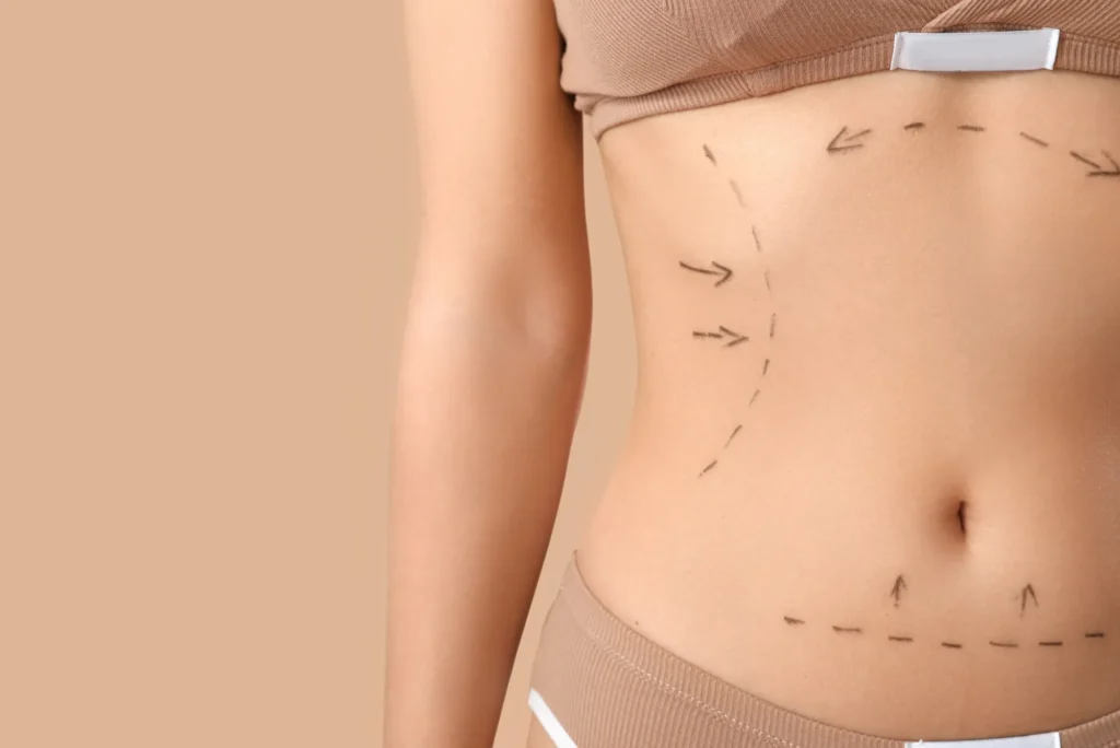 Best Time to Visit a Plastic Surgeon